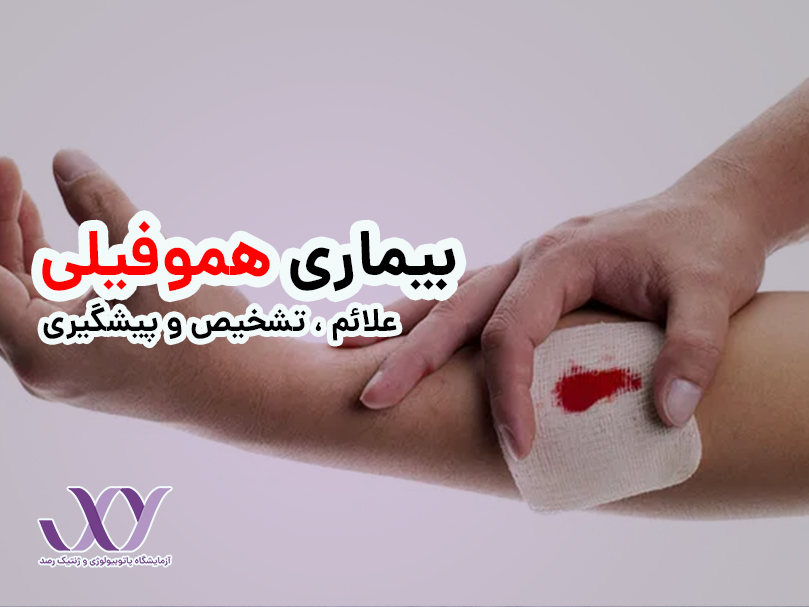 بیماری هموفیلی