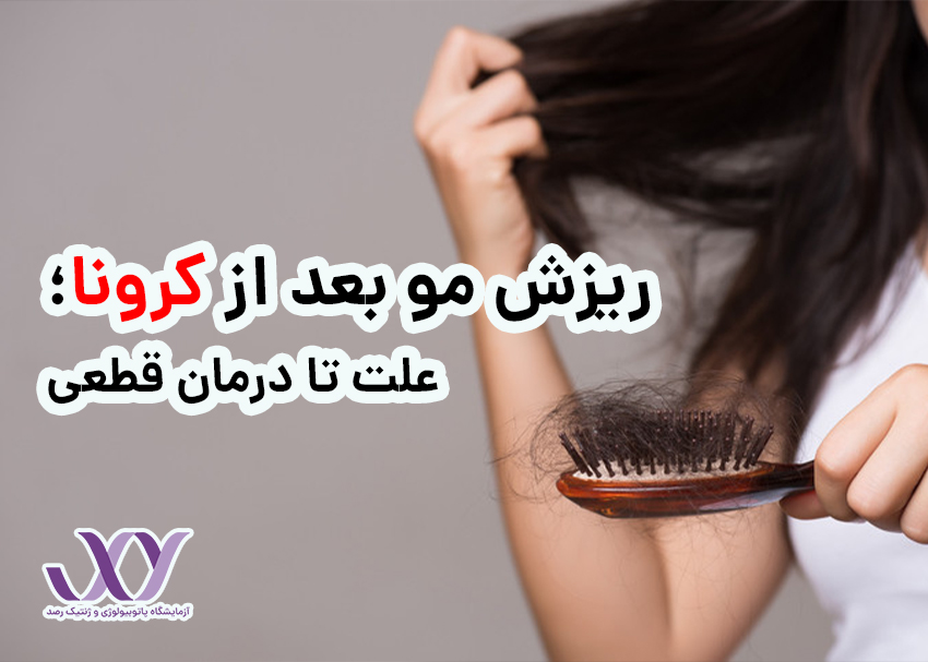 ریزش مو بعد از کرونا